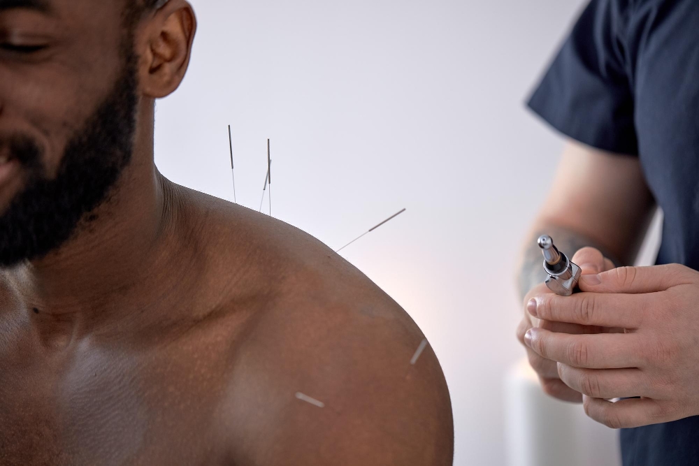(IMS) Dry Needling-img-1