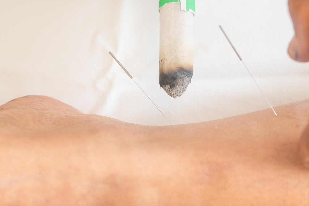(IMS) Dry Needling-img-3