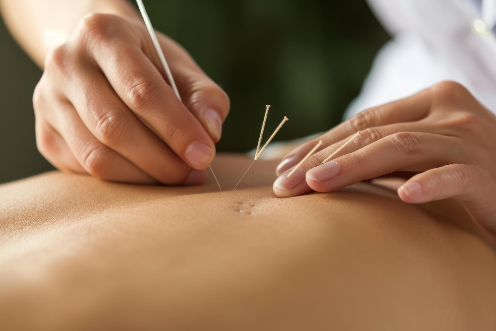 Acupuncture in Richmond
