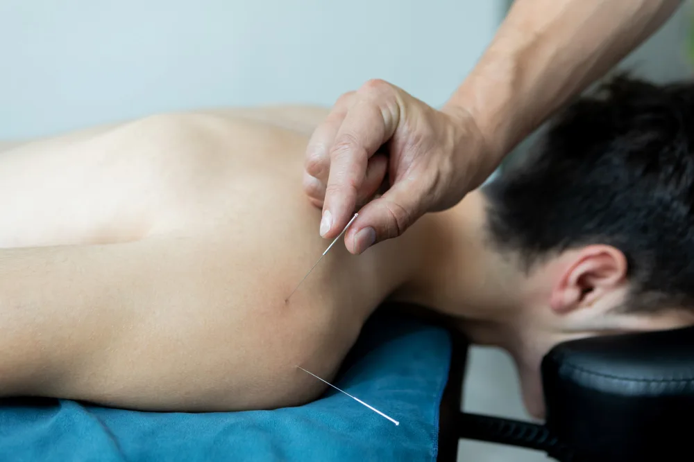 Acupuncture in Richmond