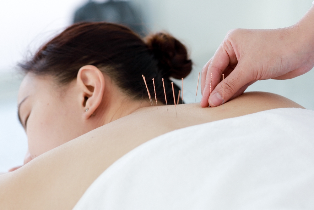 Acupuncture in Langley