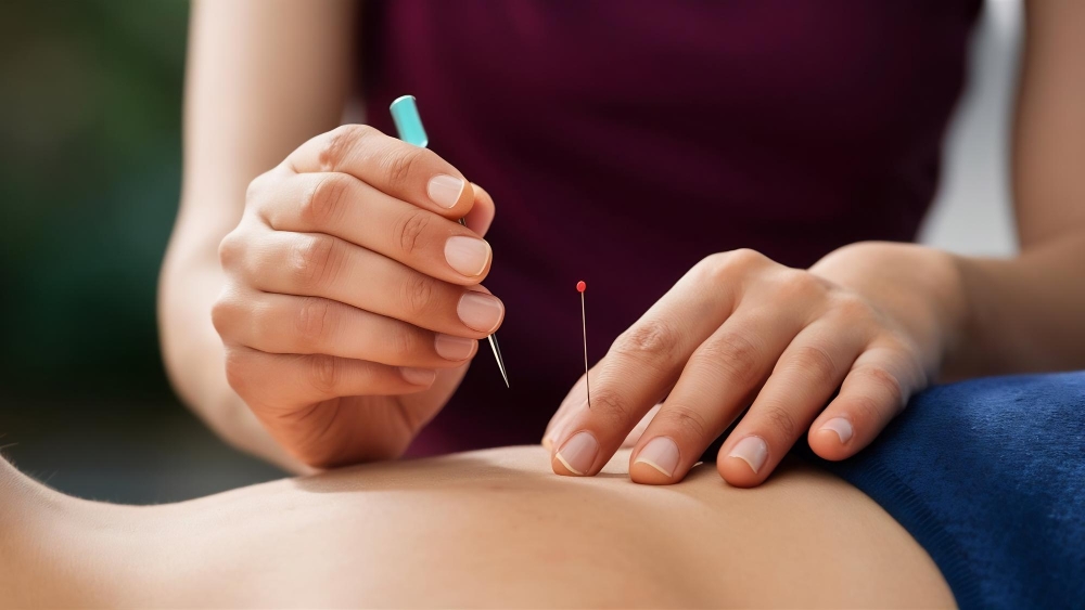 Acupuncture in Langley
