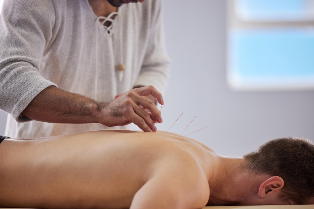Acupuncture in Langley