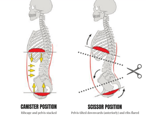 Intra Abdominal Pressure
