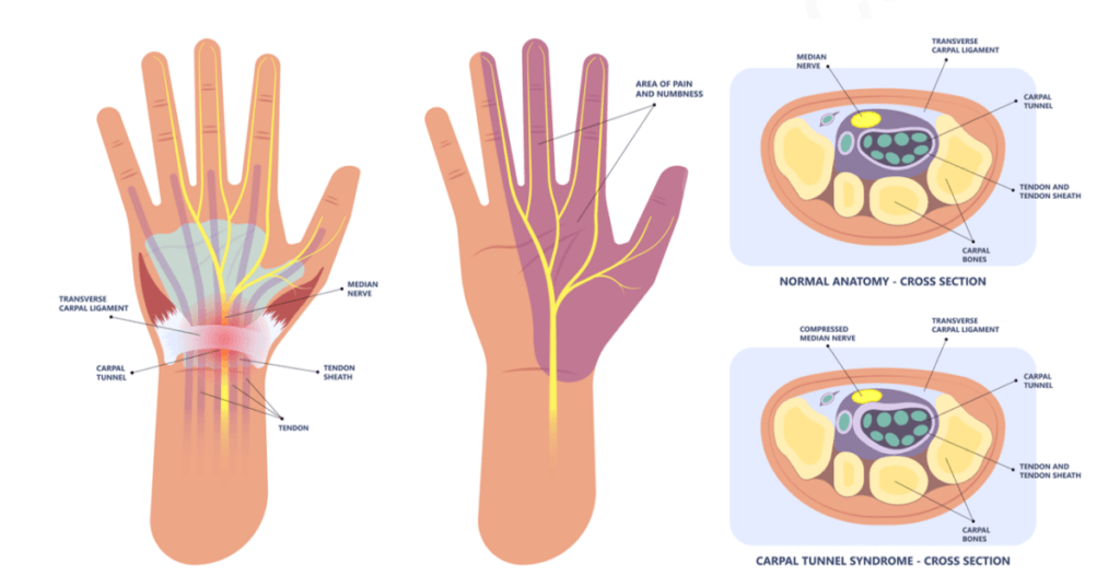 Syndrome Causes
