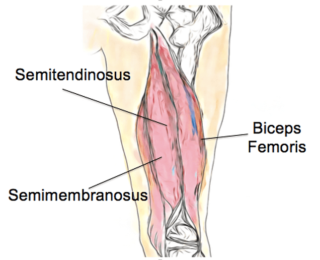 What Is Hamstring Tears? What Are The Symptoms And Causes? 1 Hamstring Tear