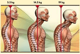 cervical instability 2