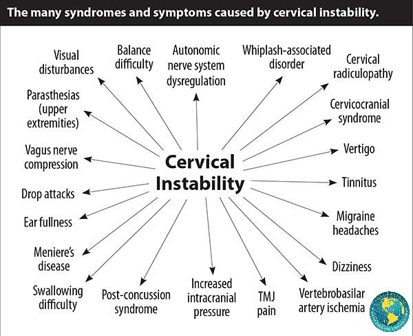 cervical instability 3