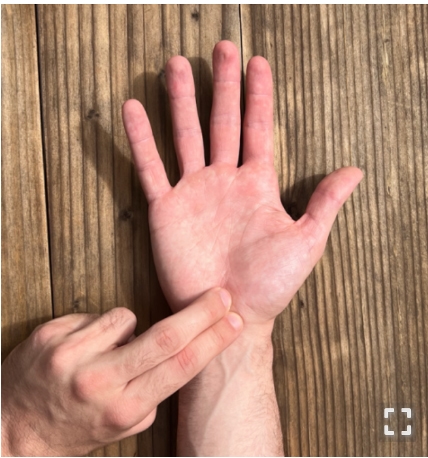 How Is Carpal Tunnel Syndrome Diagnosed
