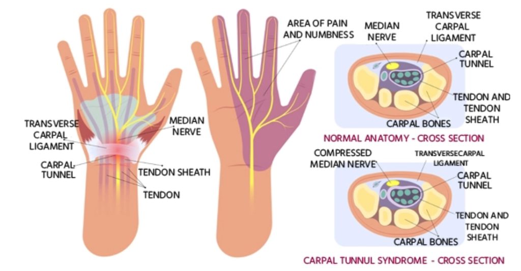 Signs and Symptoms
