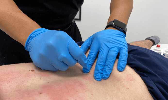 How Physiotherapy Can Help