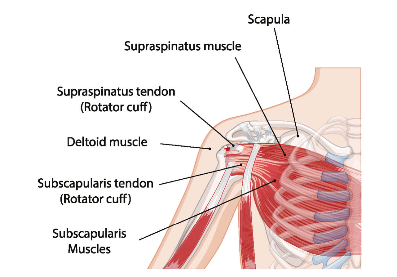 Rotator Cuff Tears: The Best Non-Surgical Treatment Option 1 Rotator Cuff Tears: The Best Non-Surgical Treatment Option