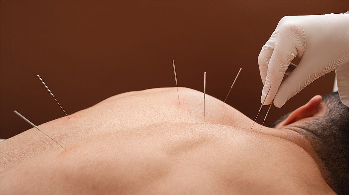 Conditions We Treat with Acupuncture Maple Ridge