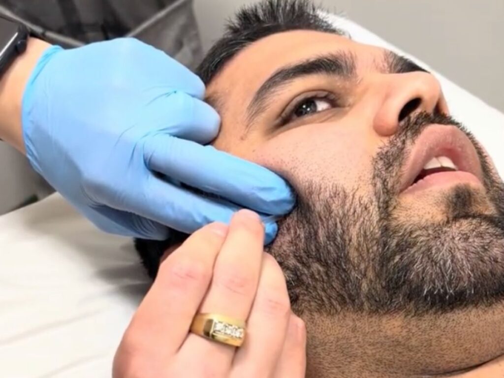 How Dry Needling Helps Tmj