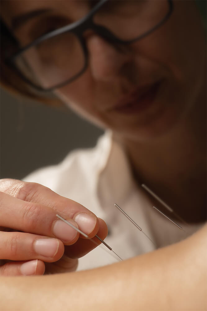 Acupuncturist Maple Ridge