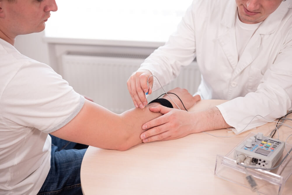 Epicondylitis Treatment Options Maple Ridge