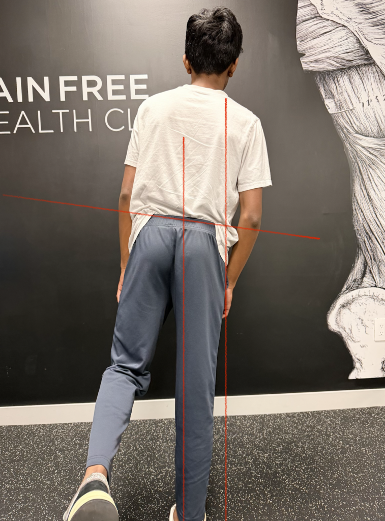 Muscle Imbalances In Soccer