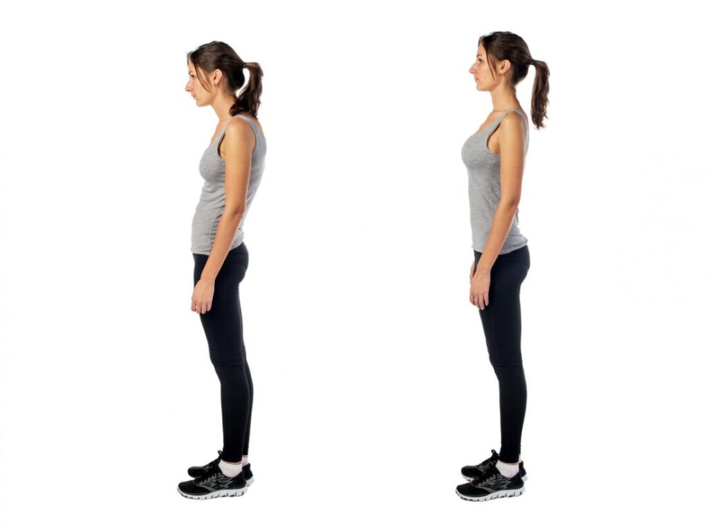 Fix Your Rounded Shoulders, Image Credit: Https://Www.medicalnewstoday.com/Articles/318556