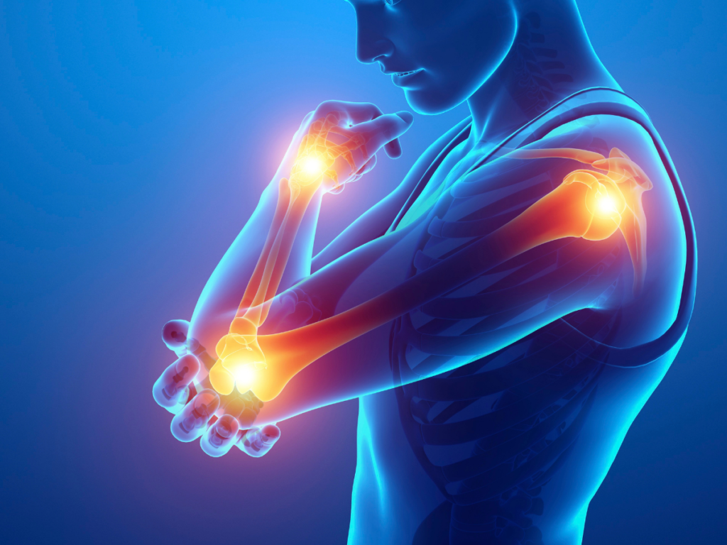 If Your Arm Keeps Going Numb, It May Not Just Be Your Muscles