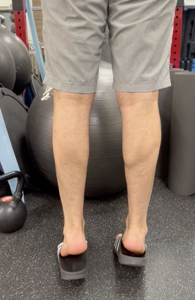 Week 1 Acl Reconstruction Exercises: 3 Essential Movements For Early Recovery 3 Heel Raises