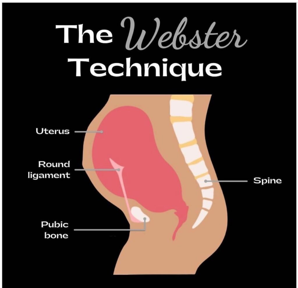 What Is The Webster Technique?