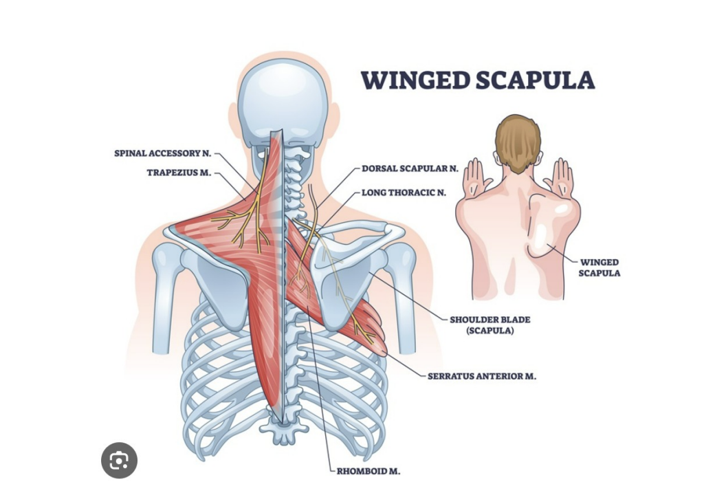 When Shoulder Dysfunction Affects More Than The Shoulder 1 The Connection Between The Scapula, Rib Cage And Athletic Performance