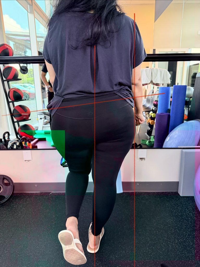 What Is Hip Biomechanics?