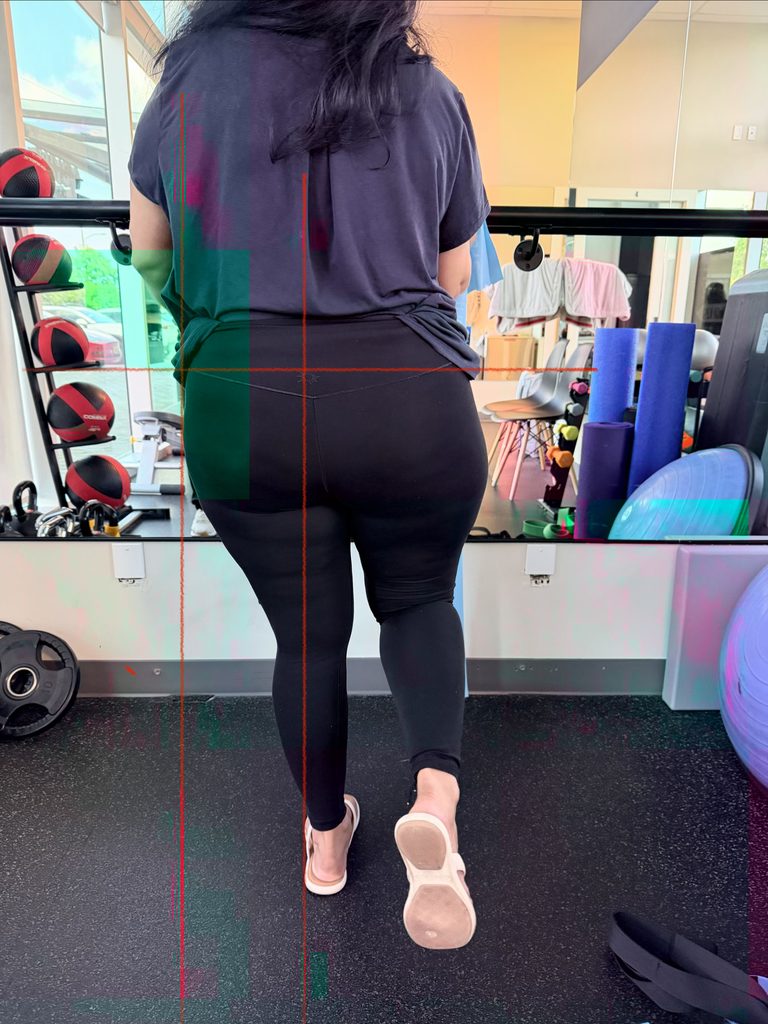 What May Be Included In A Hip Biomechanical Assessment?
