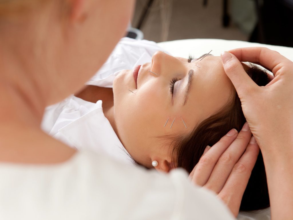 Facial Acupuncture