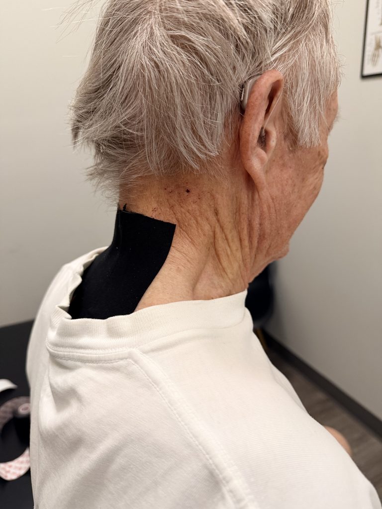 Does Neck Taping Improve Forward Head Posture?