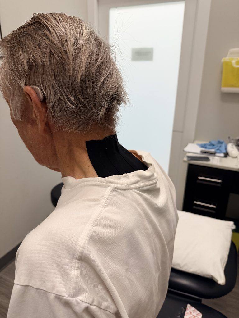 What Is Neck Taping For Forward Head Posture?